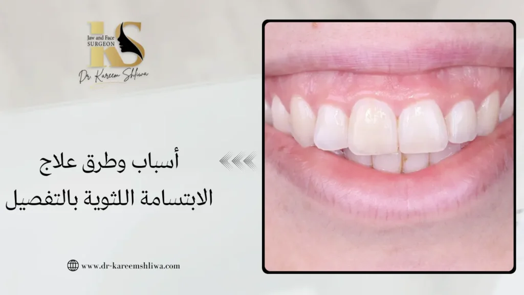 أسباب وطرق علاج الابتسامة اللثوية بالتفصيل