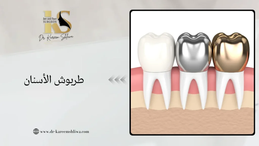 طربوش الأسنان