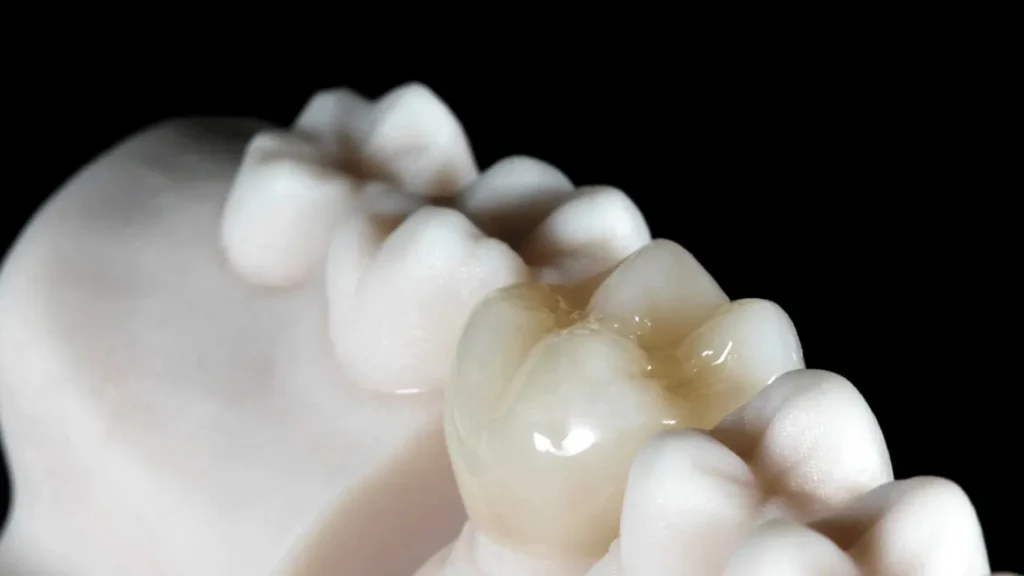 طربوش الراتنج