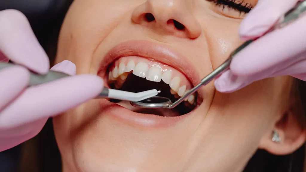 علاج حساسية الأسنان الأمامية
