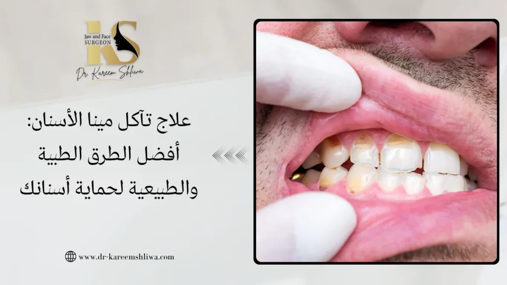 علاج تآكل مينا الأسنان: أفضل الطرق الطبية والطبيعية لحماية أسنانك