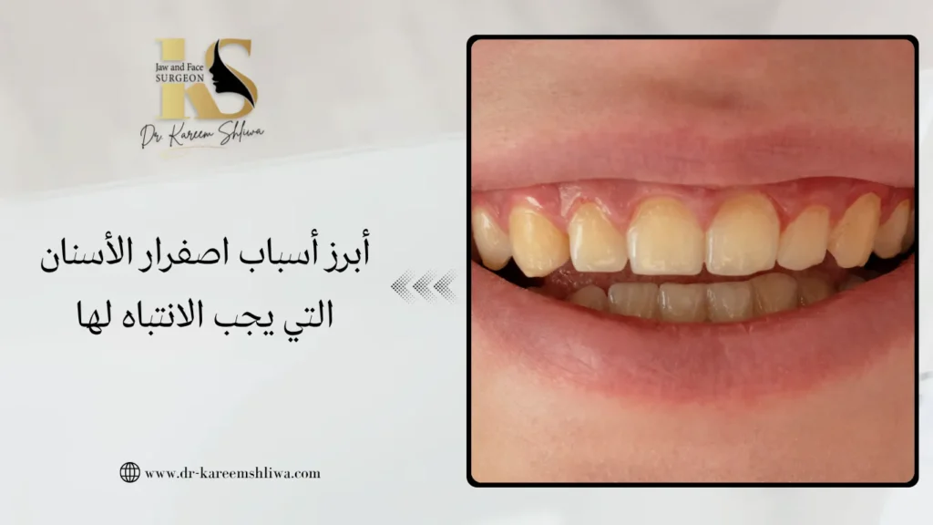 أبرز أسباب اصفرار الأسنان التي يجب الانتباه لها