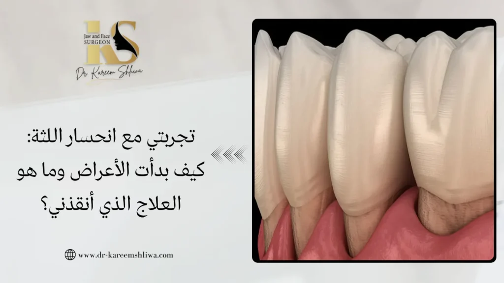انحسار اللثة
