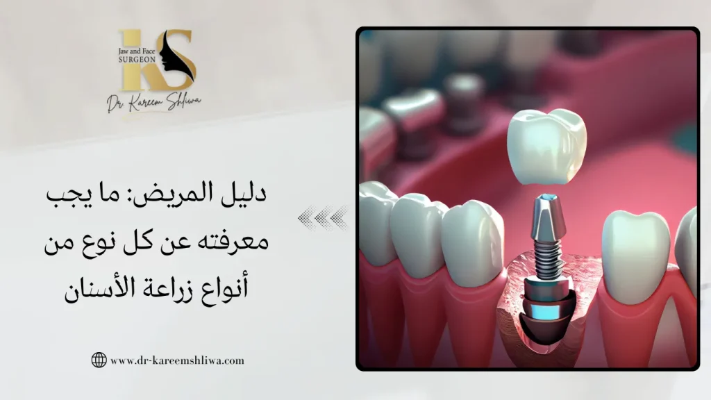 انواع زراعة الاسنان