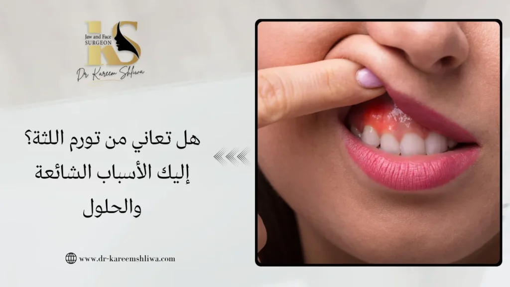 تورم اللثة