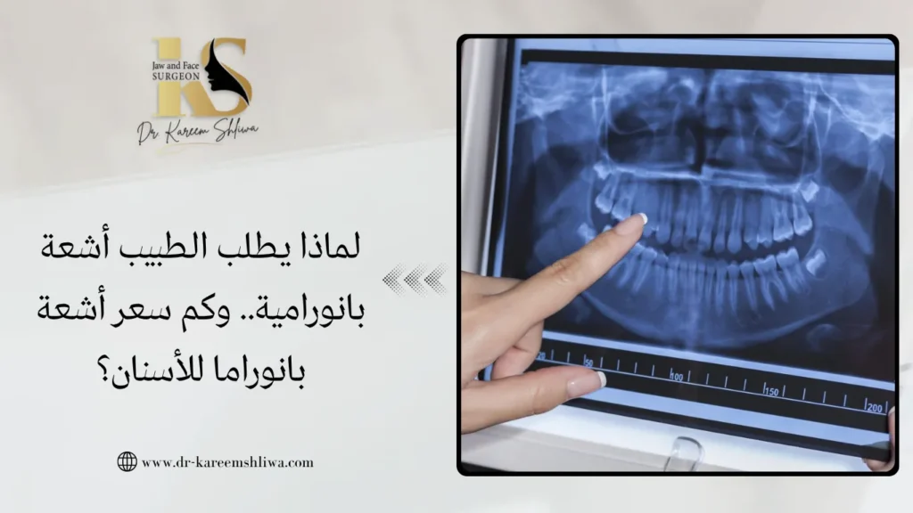 كم سعر أشعة بانوراما للأسنان
