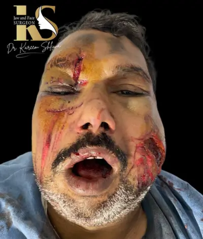 جراحة التجميل والترميم