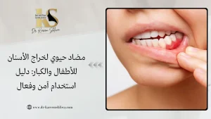 مضاد حيوي لخراج الأسنان للأطفال والكبار