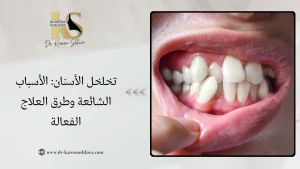 تخلخل الأسنان