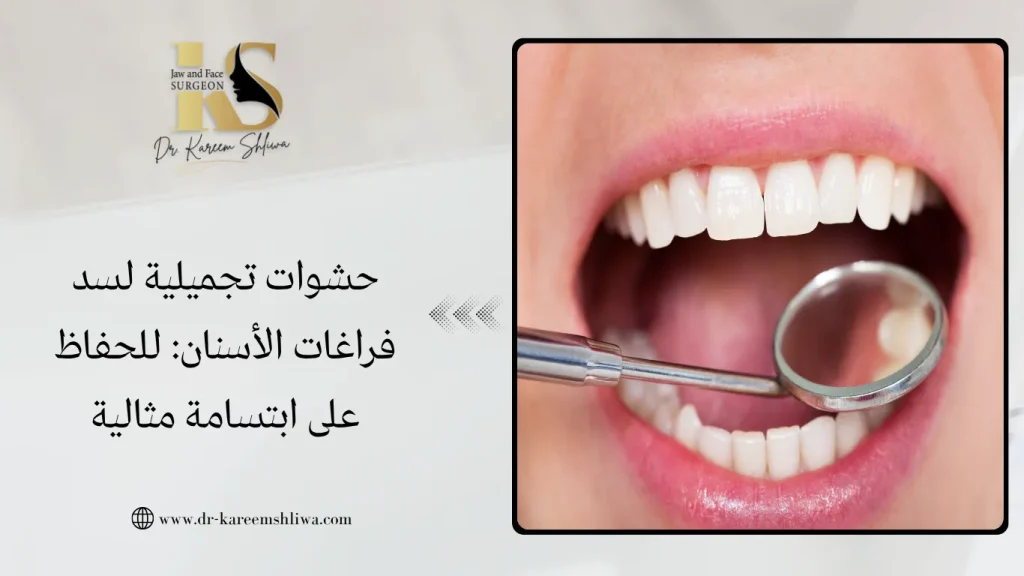 حشوات تجميلية لسد فراغات الأسنان