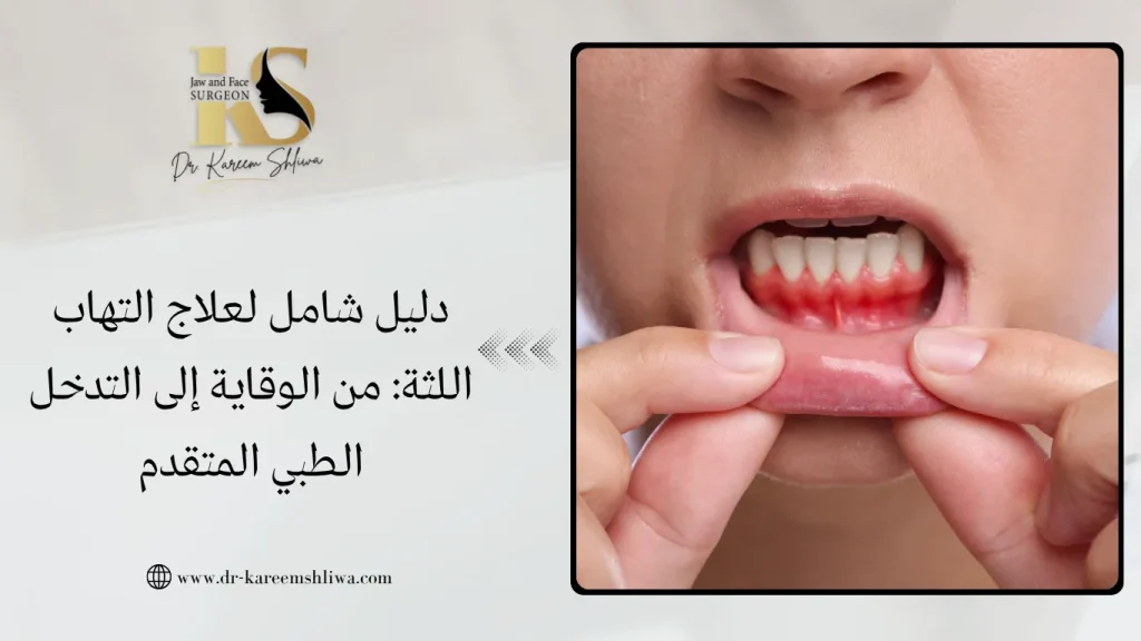 علاج التهاب اللثة