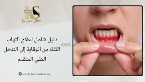 علاج التهاب اللثة