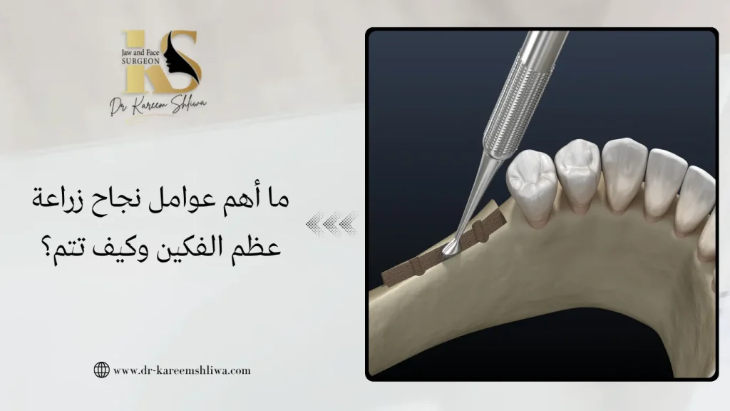 زراعة عظم الفكين