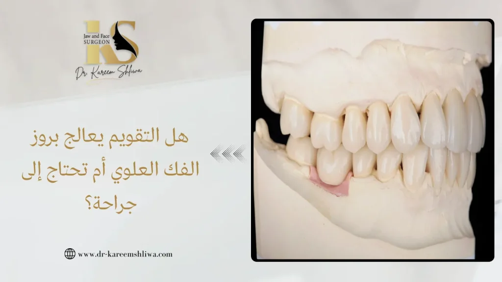 بروز الفك العلوي