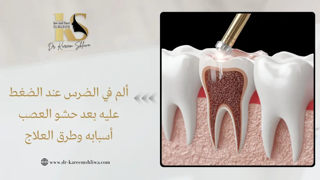ألم في الضرس عند الضغط عليه بعد حشو العصب