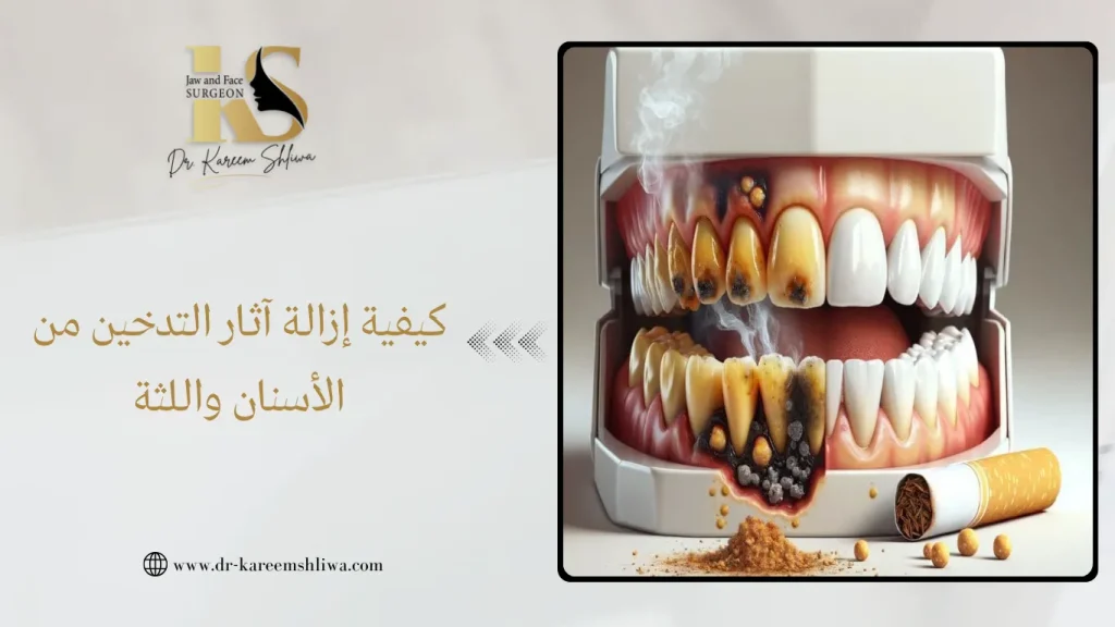 إزالة آثار التدخين من الأسنان