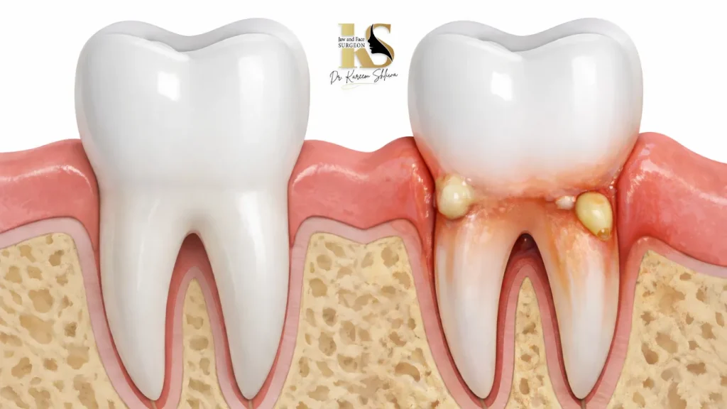 الفرق بين الطبقة البيضاء الطبيعية والعدوى