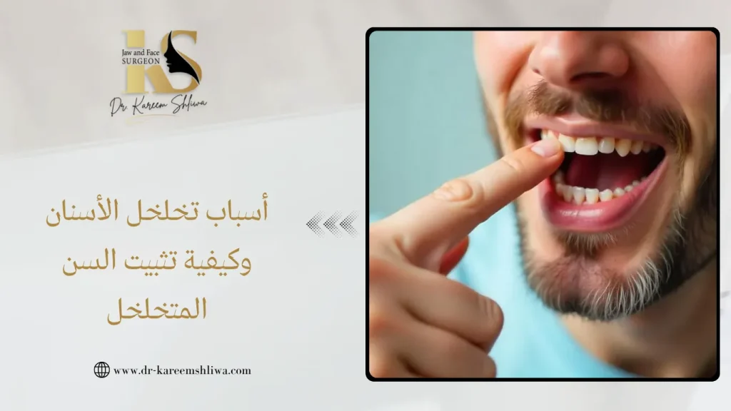 أسباب تخلخل الأسنان