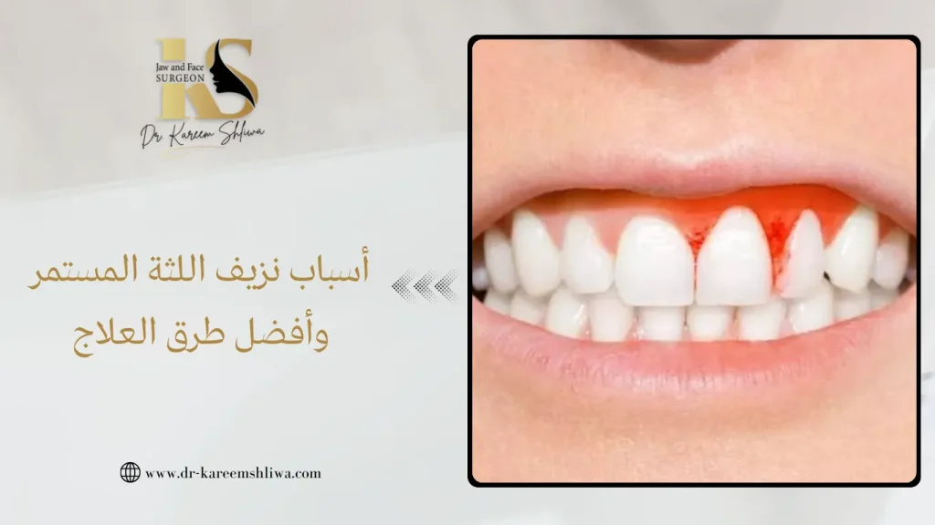 أسباب نزيف اللثة المستمر