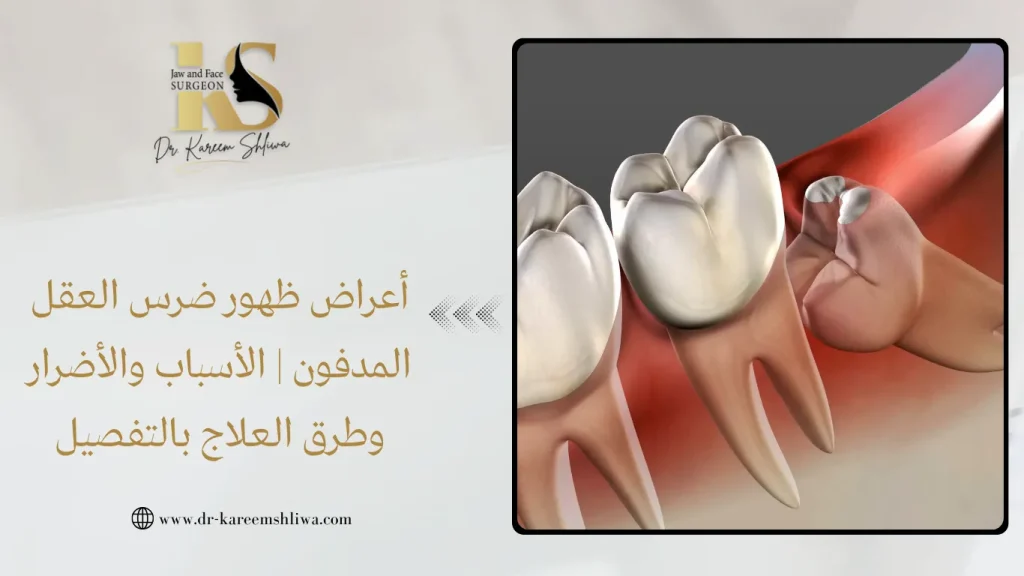 أعراض ظهور ضرس العقل المدفون