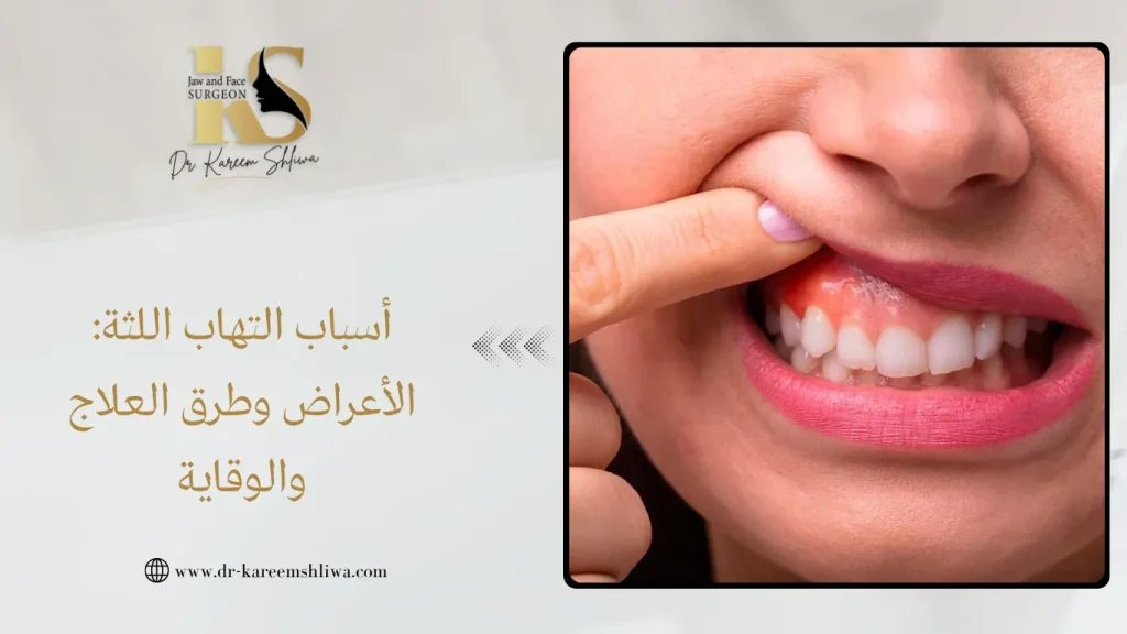 أسباب التهاب اللثة