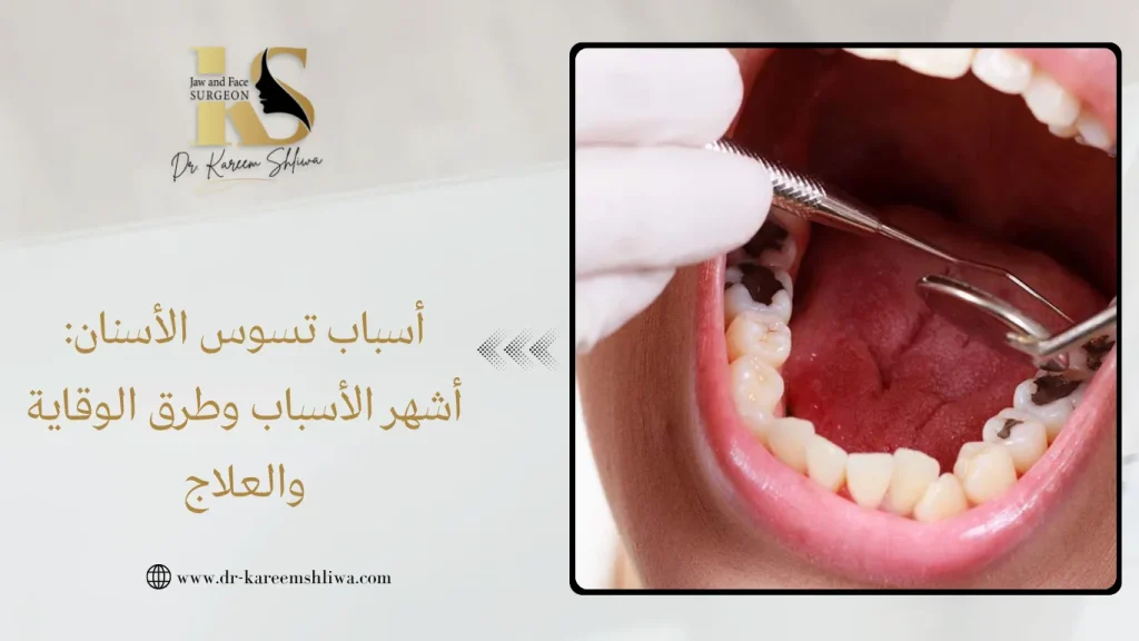 أسباب تسوس الأسنان