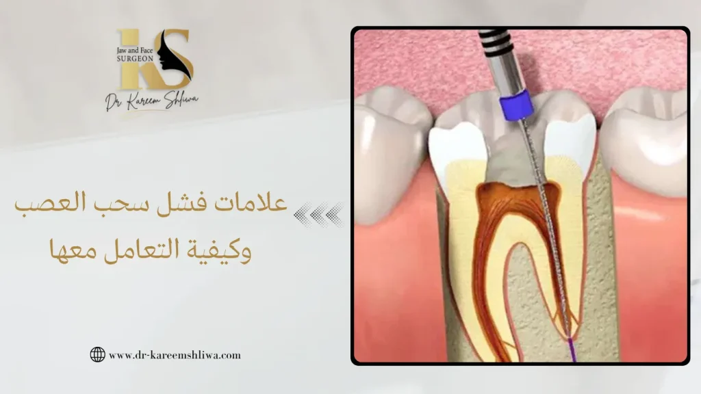 علامات فشل سحب العصب