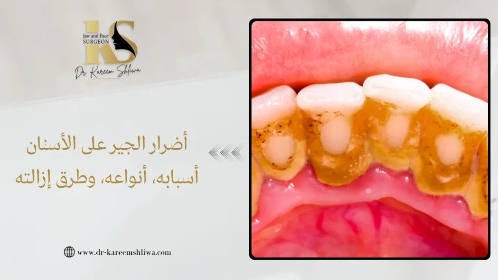 أضرار الجير على الأسنان