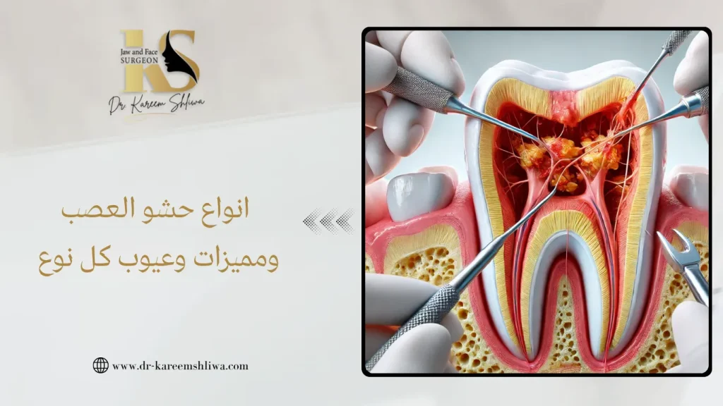 انواع حشو العصب