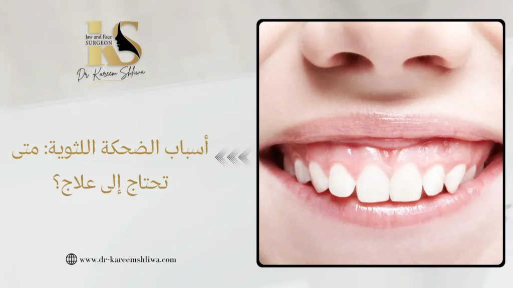 أسباب الضحكة اللثوية