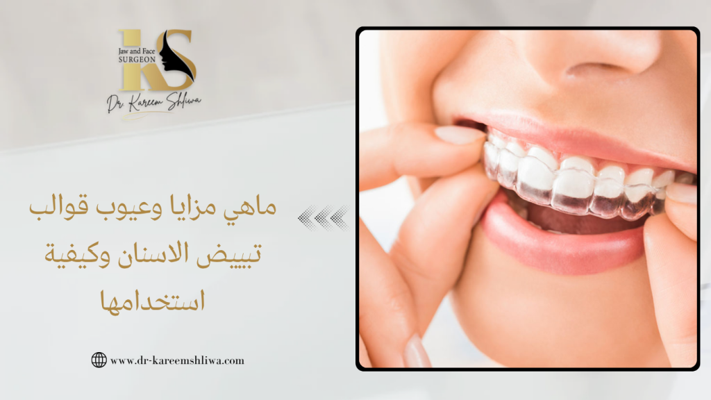 قوالب تبييض الاسنان