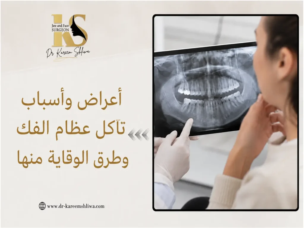 أعراض واسباب تاكل عظام الفك وطرق الوقاية منها